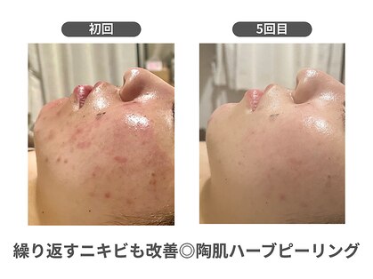 ヘアカタログ