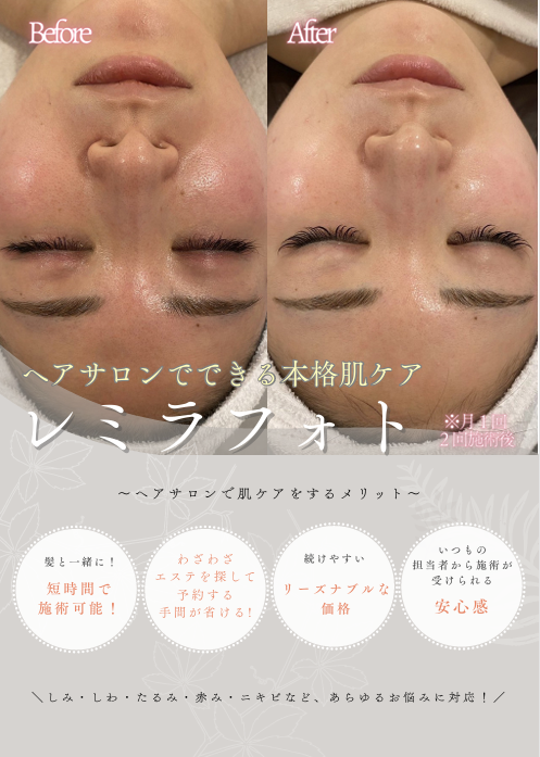 レミラフォト告知POP①