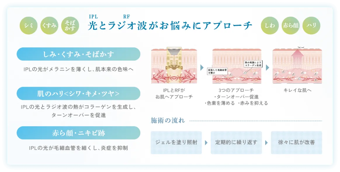 レミラフォト 光とラジオ波がお悩みにアプローチ 施術の流れ説明