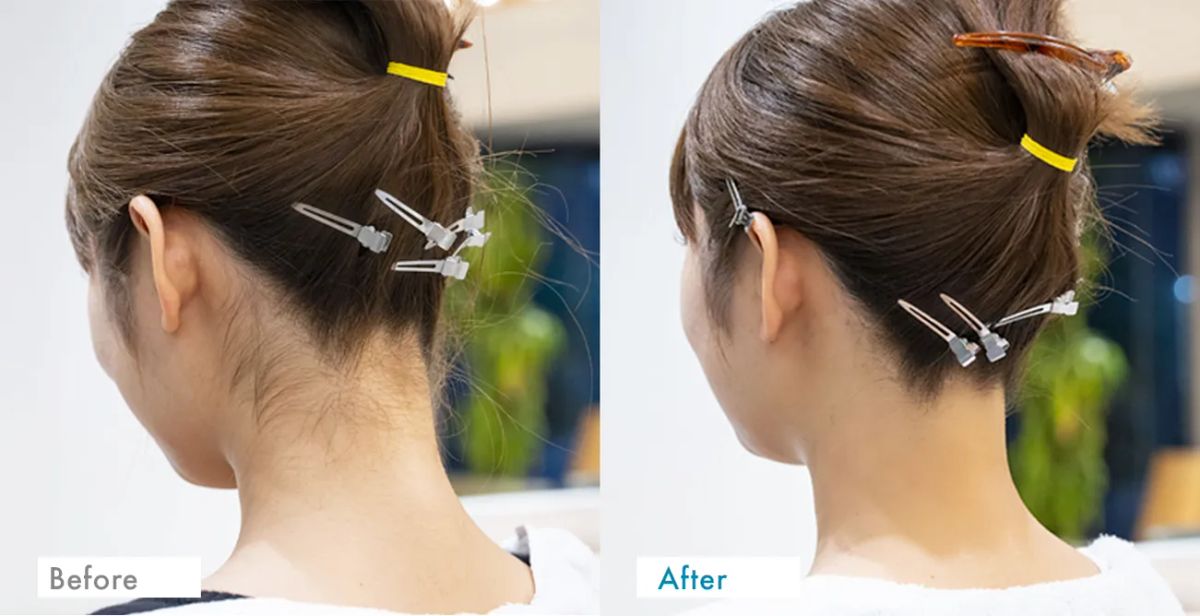 ネープケア Before After